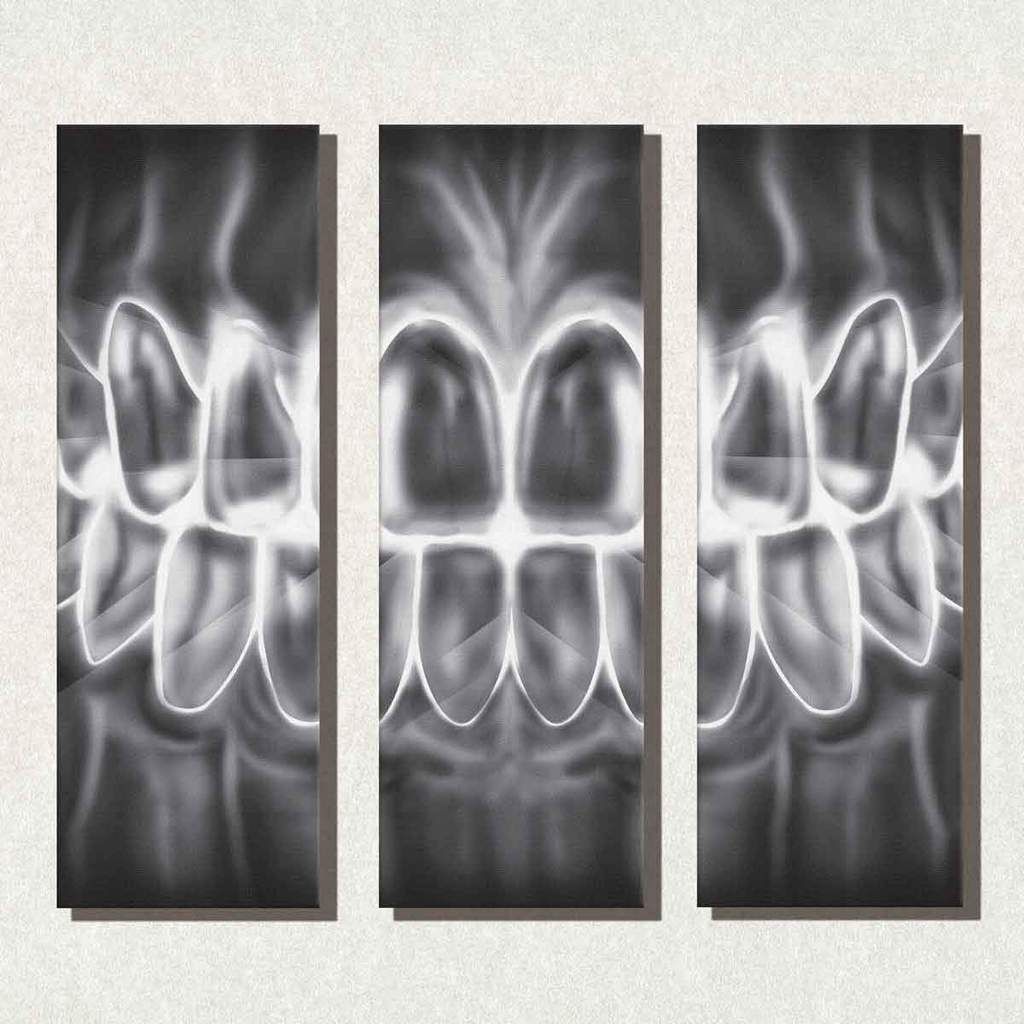 Art For Dentists Smile X Ray Multi Panel Canvas Office Wall Art Throughout Multi Panel Wall Art (View 14 of 20)